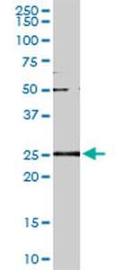 GSTA2 Antibody in Western Blot (WB)