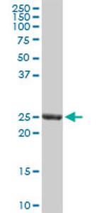GSTA3 Antibody in Western Blot (WB)