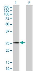 GSTA3 Polyclonal Antibody, MaxPab™
