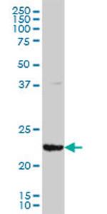 GSTA3 Antibody in Western Blot (WB)