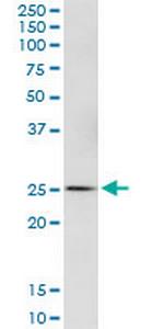 GSTA4 Polyclonal Antibody, MaxPab™