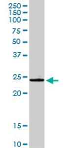 GSTA4 Antibody in Western Blot (WB)