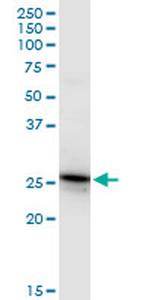 GSTA4 Antibody in Western Blot (WB)