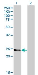 GSTM4 Monoclonal Antibody (4B4)