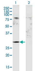 GSTM5 Polyclonal Antibody, MaxPab™