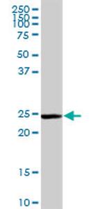 GSTM5 Antibody in Western Blot (WB)