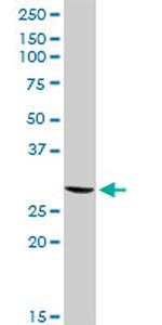 GSTT2 Antibody in Western Blot (WB)