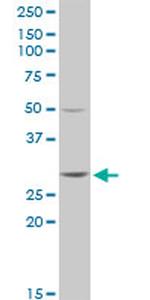 GSTT2 Antibody in Western Blot (WB)