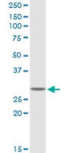 GSTT2 Antibody in Western Blot (WB)