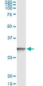 GSTT2 Monoclonal Antibody (1C12)