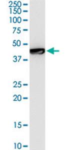 GTF2E1 Antibody in Western Blot (WB)