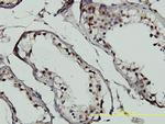 GTF2H1 Antibody in Immunohistochemistry (Paraffin) (IHC (P))