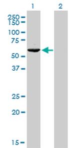 GTF2H1 Antibody in Western Blot (WB)