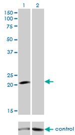 GUCA1A Monoclonal Antibody (2F7)
