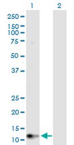 GUCA2B Antibody in Western Blot (WB)