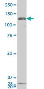 GUCY2C Monoclonal Antibody (1B11)