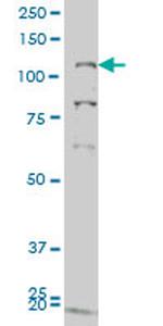 GUCY2C Antibody in Western Blot (WB)
