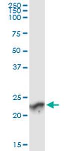 GUK1 Monoclonal Antibody (4C3-1A7)