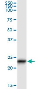 GUK1 Antibody in Immunoprecipitation (IP)
