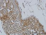GYG1 Monoclonal Antibody (3B5)