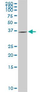 GYG1 Monoclonal Antibody (2C10)
