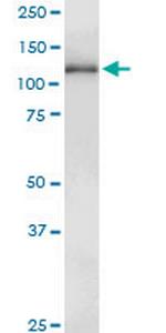 GUCY2D Monoclonal Antibody (4E12)