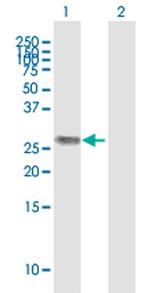 H1F0 Polyclonal Antibody, MaxPab™