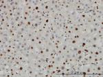 H3F3B Antibody in Immunohistochemistry (Paraffin) (IHC (P))