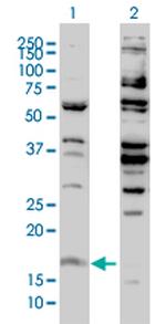 H3F3B Antibody in Western Blot (WB)