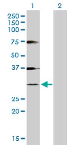 HIST1H1A Antibody in Western Blot (WB)