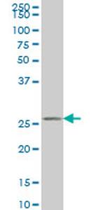 HAGH Antibody in Western Blot (WB)