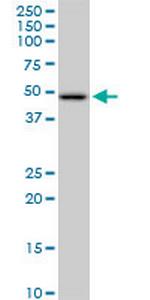 HADHB Antibody in Western Blot (WB)