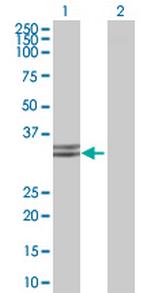 HADHSC Polyclonal Antibody, MaxPab™