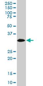 HADHSC Monoclonal Antibody (3C9)