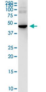 HARS Antibody in Western Blot (WB)
