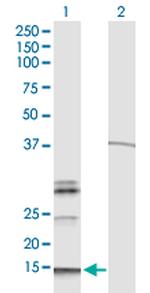 HBG1 Monoclonal Antibody (M2)