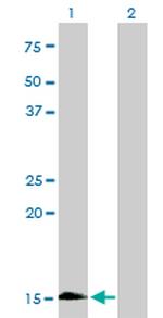 HBZ Monoclonal Antibody (3C4-1D5)