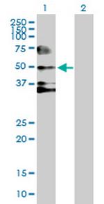 SERPIND1 Antibody in Western Blot (WB)