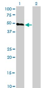 HCRTR2 Antibody in Western Blot (WB)