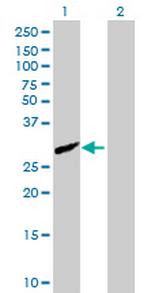 CFHR2 Polyclonal Antibody, MaxPab™