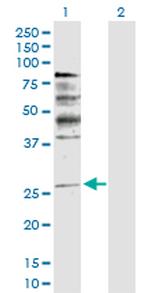 NRG1 Polyclonal Antibody, MaxPab™