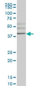 HHEX Monoclonal Antibody (3F11)