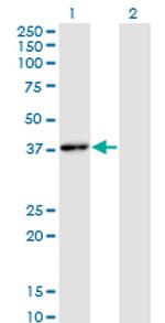 HHEX Monoclonal Antibody (1A5)