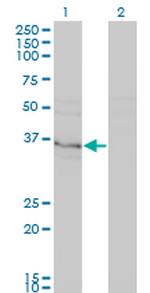 HHEX Monoclonal Antibody (1A2)