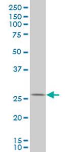 HHEX Antibody in Western Blot (WB)