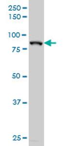 HIC1 Antibody in Western Blot (WB)
