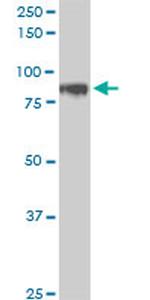 HIC1 Antibody in Western Blot (WB)