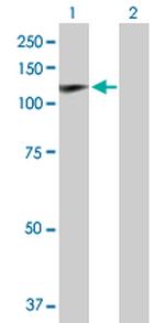 HIP1 Polyclonal Antibody, MaxPab™