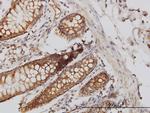 HIP1 Monoclonal Antibody (1F12)