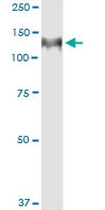 HIP1 Antibody in Immunoprecipitation (IP)